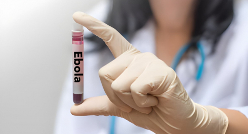 Uganda chiude il focolaio Ebola Bundibugyo dopo 42 giorni senza casi